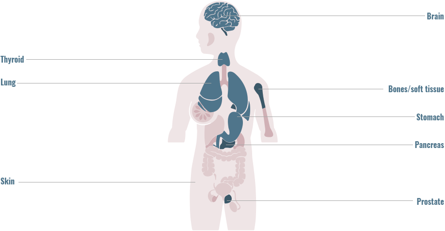 Distribution of BRAF/CRAF gene fusions across primary tumor sites graphic